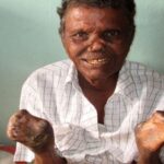 LENT. JUBILEE. THE POWER OF SMALL ACTS