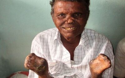 LENT YEAR OF ST FRANCIS.  COMPASSION