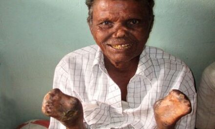 LENT YEAR OF ST FRANCIS.  COMPASSION